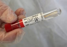 Регистрирани са още двама заразени с коронавирус жители на област Разград