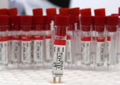 90 New Cases of COVID-19 Confirmed in Bulgaria in the Past 24 hours