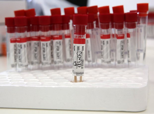 Заболеваемостта от COVID-19 в област Пловдив надхвърли на 14-дневна база 300 на 100 000 души население