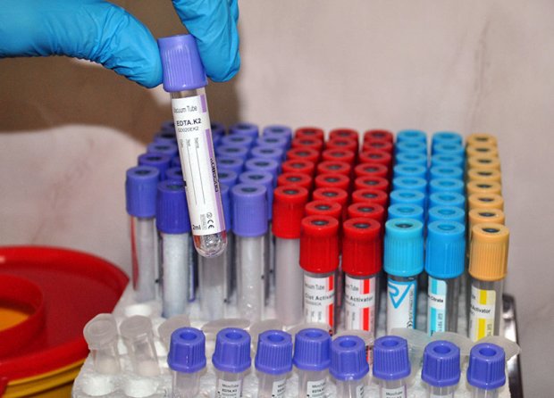 Няма положителни за COVID-19 сред учителите в Монтанско