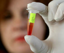 РЗИ-Ловеч е изпратила за изследване десет проби на заболели от грип