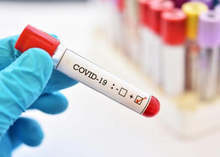 Значителен спад на новозаболелите с COVID-19 отчитат в община Сливен