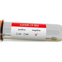 Само четири са новите случаи на COVID-19 в област Кюстендил за изминалото денонощие