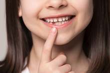 Кампания за поставяне на силанти при децата се провежда в Разград