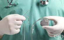 Във видинската болница от началото на 2021 г. стартира имплантирането на пейсмейкъри