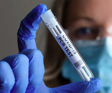 Във видинската болница "Св. Петка" могат да се правят PCR тестовеи в събота