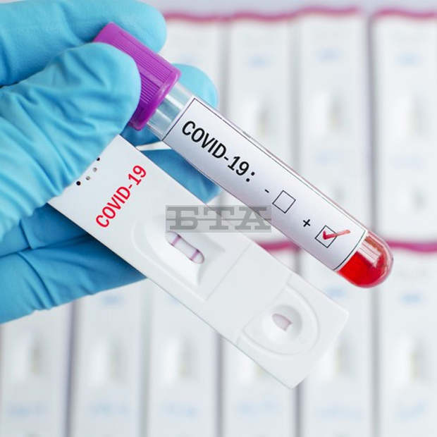 Намаляватноводиагностицираните с COVID-19 в Шуменско