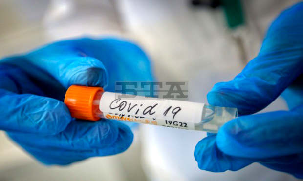 В област Сливен под карантина са 849 души, шестима са новозаразените с COVID-19 В област Сливен под карантина са 849 души, шестима са новозаразените с COVID-19