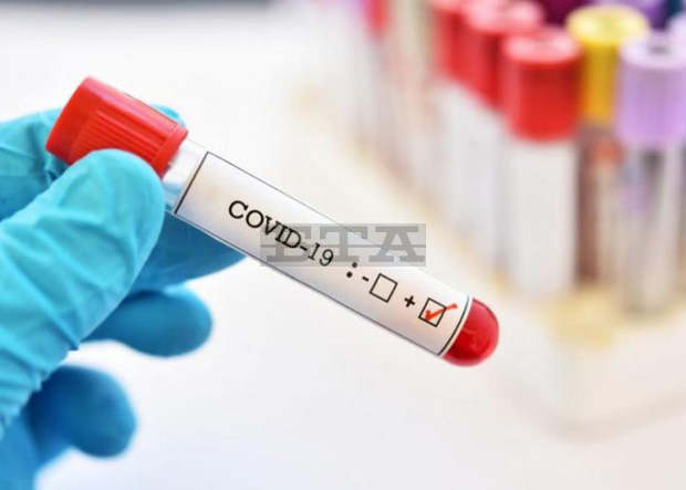 Значителен спад на новозаболелите с COVID-19 отчитат в община Сливен Значителен спад на новозаболелите с COVID-19 отчитат в община Сливен