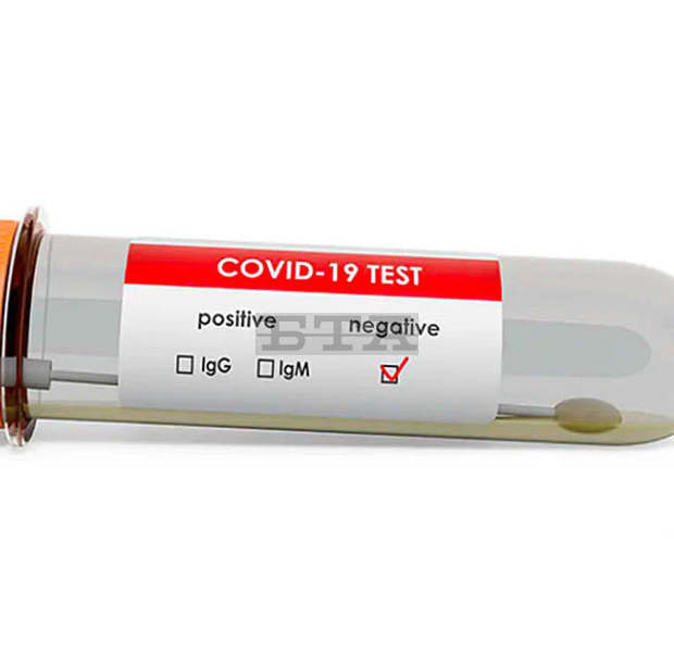 Само четири са новите случаи на COVID-19 в област Кюстендил за изминалото денонощие