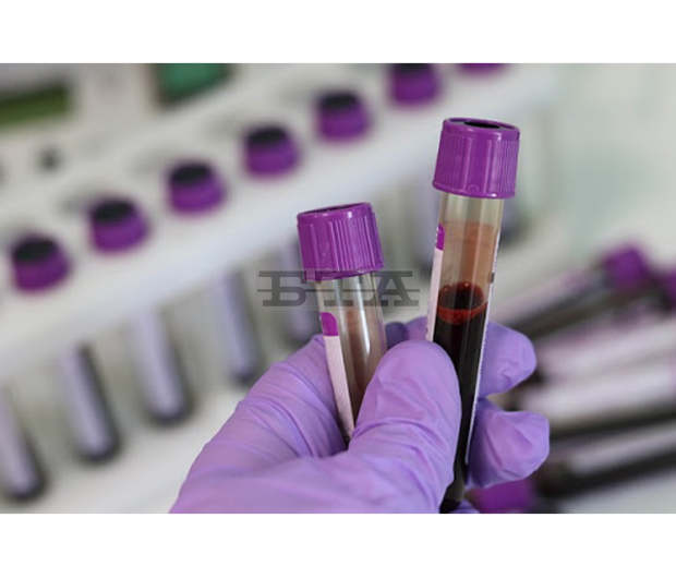 Депутат от Монтана ще покрива транспортни разходи до София на преболедували COVID-19 да дарят кръвна плазма