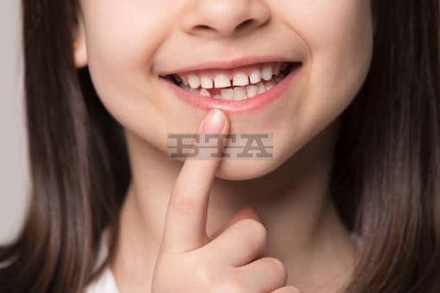 Кампания за поставяне на силанти при децата се провежда в Разград