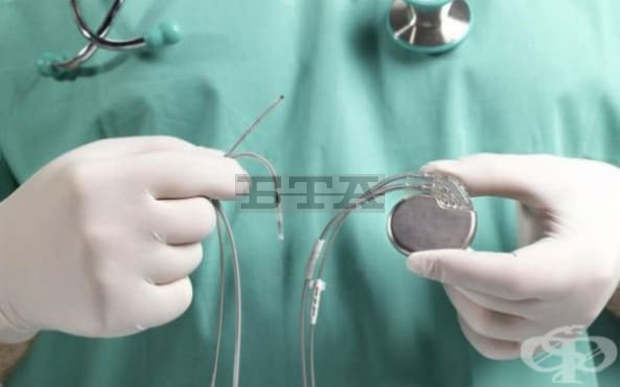 Във видинската болница от началото на 2021 г. стартира имплантирането на пейсмейкъри