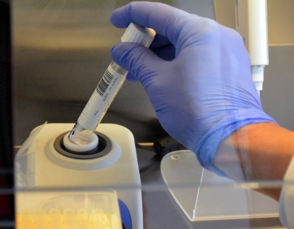 COVID-19 Update: 10,151 New Cases, Test Positivity Rate at 24%