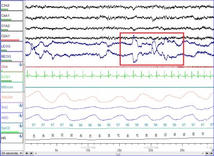 Sleep Changes in Extreme Weather Studied during Bulgarian Antarctic Expedition Sleep Changes in Extreme Weather Studied during Bulgarian Antarctic Expedition