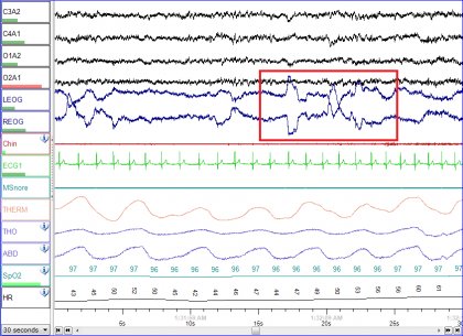 Sleep Changes in Extreme Weather Studied during Bulgarian Antarctic Expedition