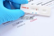 Над 8100 нови случая на коронавирус второ поредно денонощие в България; 100 души са починали